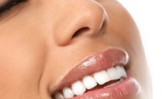 Отбеливание зубов перекисью водорода