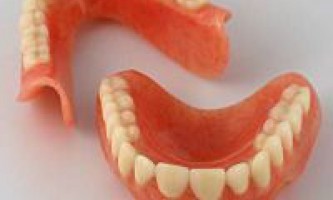 Съемные зубные протезы – какие лучше?