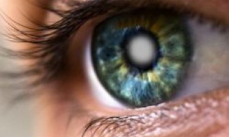 Симптомы катаракты на ранних стадиях