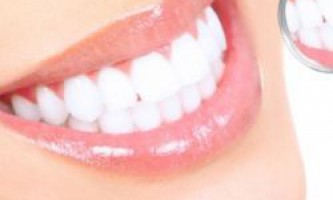 Зубной камень - лечение